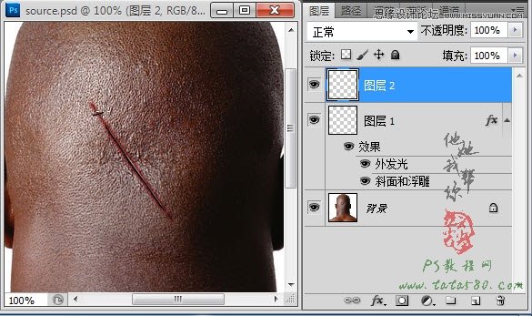 Photoshop合成人物缝合的伤口效果教程,PS教程,图老师教程网