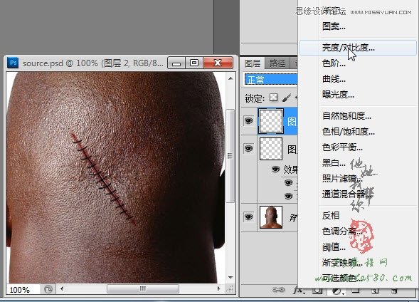 Photoshop合成人物缝合的伤口效果教程,PS教程,图老师教程网