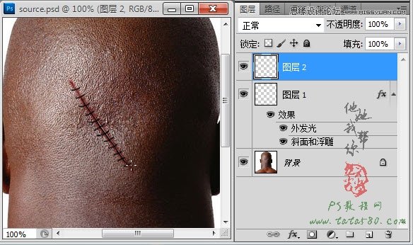 Photoshop合成人物缝合的伤口效果教程,PS教程,图老师教程网